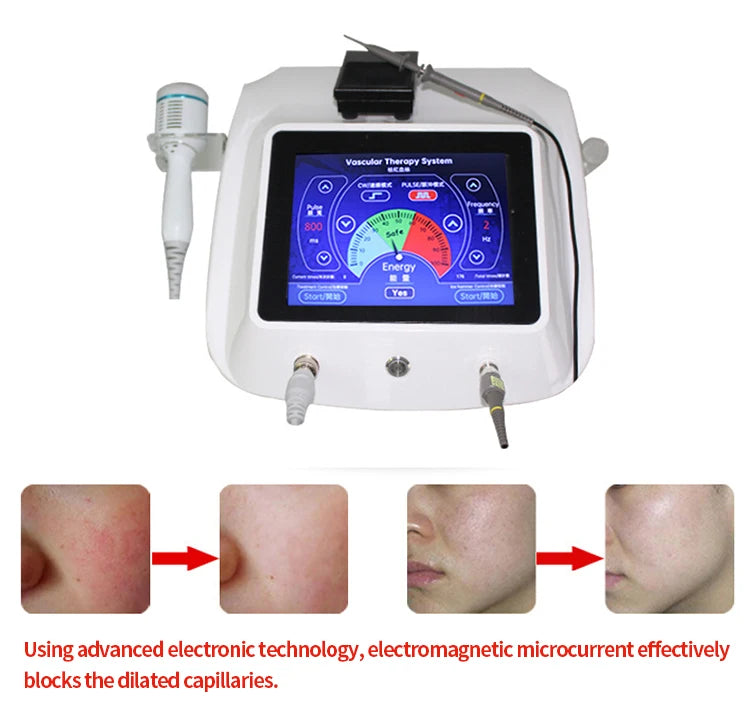 Newest 2-In-1 High Frequency Vascular Removal Machine 13.56MHZ Painless Spider Vein Remover RF Blood Vessel Removal Device